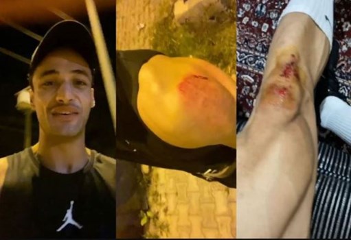 आसिम रियाज पर बाइक सवार ने किया हमला, बुरी तरह हुए घायल