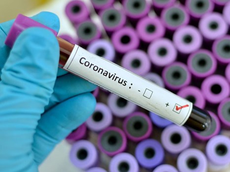 देश में पिछले 24 घंटे में कोरोना के 66,999 नए मामले आए सामने, संक्रमितों की कुल संख्या 24 लाख के पास
