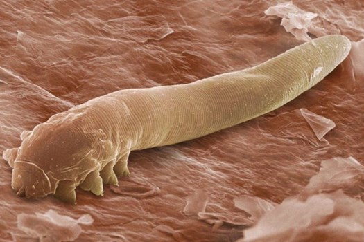 नहीं होगा यकीन पर है सच, आपके चेहरे और शरीर पर हर वक्त होते हैं लाखों कीड़े 