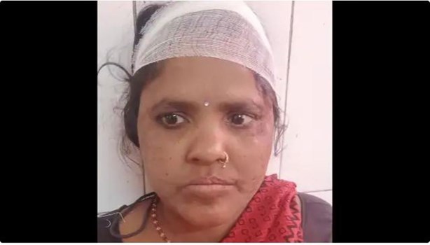 Sitapur: कूड़ा डालने से मना करने पर होमगार्ड के पूरे परिवार को दबंगों ने लाठी-डंडे से पीटा