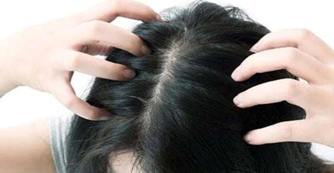 Hair Care Tips: सिर पर हो फंगल इंफेक्शन तो आजमाएं ये घरेलू नुस्खे, तुरंत मिलेगी राहत 