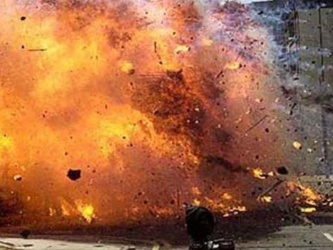 Pakistan के कराची में बड़ा धमाका, 13 लोग घायल, कचरे के ढेर में छिपाया गया था विस्फोटक