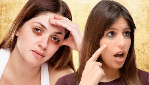 काले घेरे से चाहिए छुटकारा, इन घरेलू उपायों से मिलेगी राहत