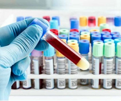 आज से हिमाचल के सरकारी अस्पतालों में मुफ्त होंगे 233 टेस्ट