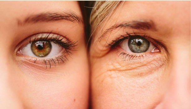 Beauty Tips: आंखों के आसपास ही क्यों आती हैं झुर्रियां, जानिए इसका कारण और बचाव