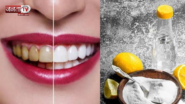पीले हो रहे हैं दांत तो ऐसे करें साफ़, कुछ ही दिनों में दिखने लगेगा असर, चमकेंगे दांत 
