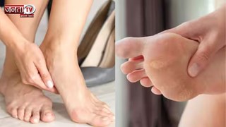 सर्दी में फटने लगी हैं एड़ियां, आजमाएं ये घरेलू नुस्खे, तुरंत मिलेगा आराम 