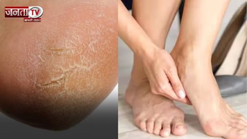 सर्दियों में एड़ियां इतनी क्यों फटती हैं? इन्हें कैसे ठीक रखा जाए, जानिए यहां
